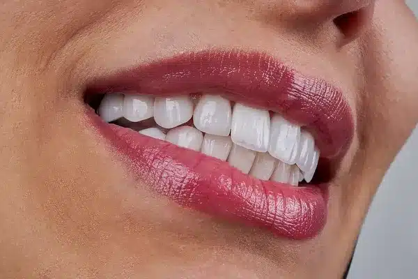 Cosmetic dental treatment